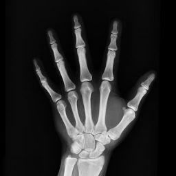 hand-bone